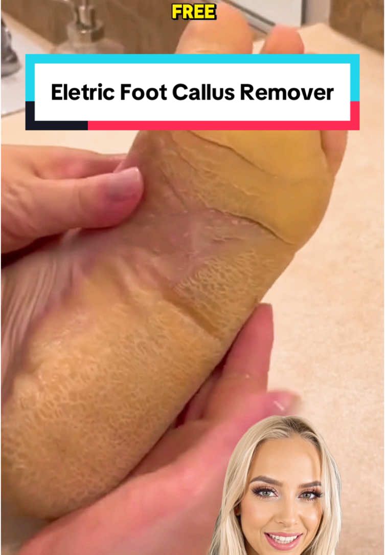 Effortlessly sand away hard skin  #pedicure  #footcare    #electricsander  #feet  #hardskinremoval    #fyptiktok    #tiktokmademebuyit 