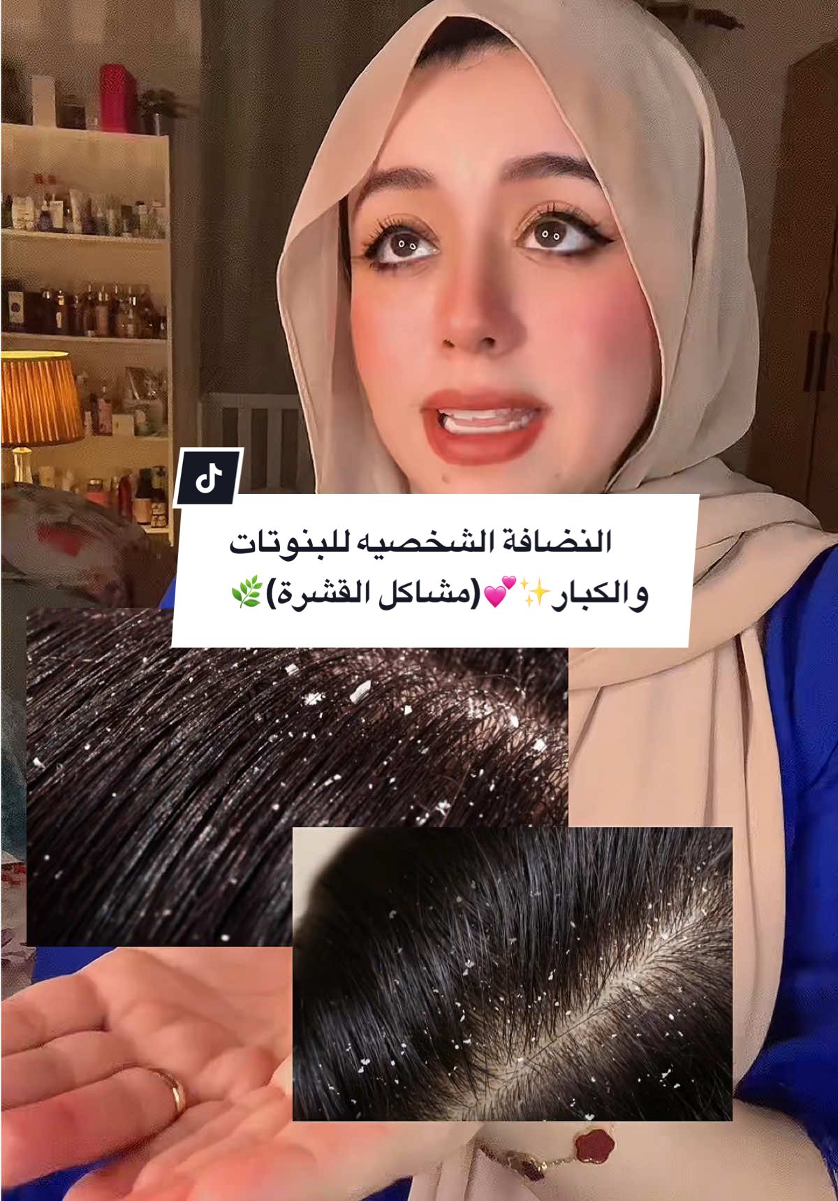 النضافة الشخصيه للبنوتات والكبار✨💕(مشاكل القشرة)🌿 @𝐕𝐢𝐭𝐨𝐜𝐚𝐫𝐞 𝐄𝐠𝐲𝐩𝐭 💕✨ #fyppppppppppppppppppppppp #fyp #dandrufftreatment #القشرة #العيد #العيد_الكبير #علاج_القشرة #fypシ゚ #kuwait🇰🇼 #egypt 