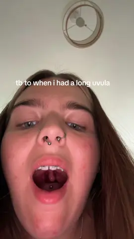 sorry for the noises #trending #fyp #foryoupage #viral #onthisday #tonsillitis 