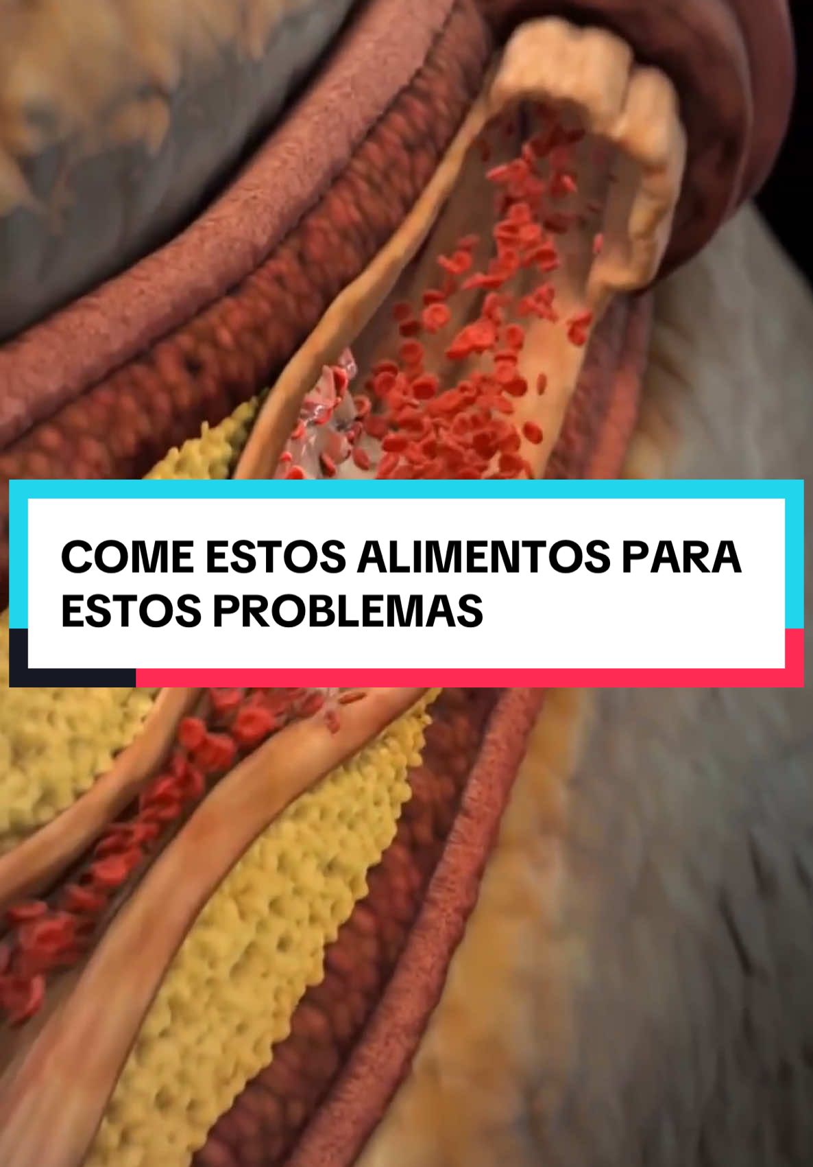 🌿Come Estos Alimentos Para Estos Problemas REVISA MI LIBRO”Los Secretos Curativos de la Naturaleza “ ENLACE EN LA BIO👆 💬 ¿Desde dónde nos estás viendo? Cuéntanos en los comentarios 📲 Síguenos para optimizar tu salud #remedios #remediosnaturales #salud #saludybienestar #vidasana #consejos #remedioscaseros #frutas #alimentos 