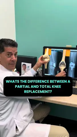 What’s the Difference Between a Total & a Partial Knee Replacement? The knee has three compartments: medial, lateral, and patellofemoral. If damage is limited to one or two of these compartments, a partial knee replacement may be appropriate—preserving healthy tissue and often allowing for a faster recovery and more natural movement. If all three compartments are worn out, a total knee replacement is typically recommended to restore full joint function. Here at Victory in Motion, Home of Knee Repair, NOT Knee Replacement” Our mission is to be Knee Replacement Free by 2043 & we're here to support your journey back to mobility and confidence! Email: regen@victoryinmotion.com Phone: (315) 685-7544 #Victoryinmotion #Kneereplacement #Mobility #KneeExtension #PhysicalTherapy #Rehabilitation #KneeHealth #KneeRecovery #QuadStrength #Stretching #PostSurgeryRecovery #Replacementsurgery #painrelief #kneepain #meniscus Medical Disclaimer: This is for informational purposes only and not a substitute for professional medical advice. Always consult your doctor or qualified healthcare provider for personalized guidance.