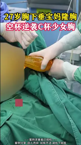 平底起高楼#隆胸