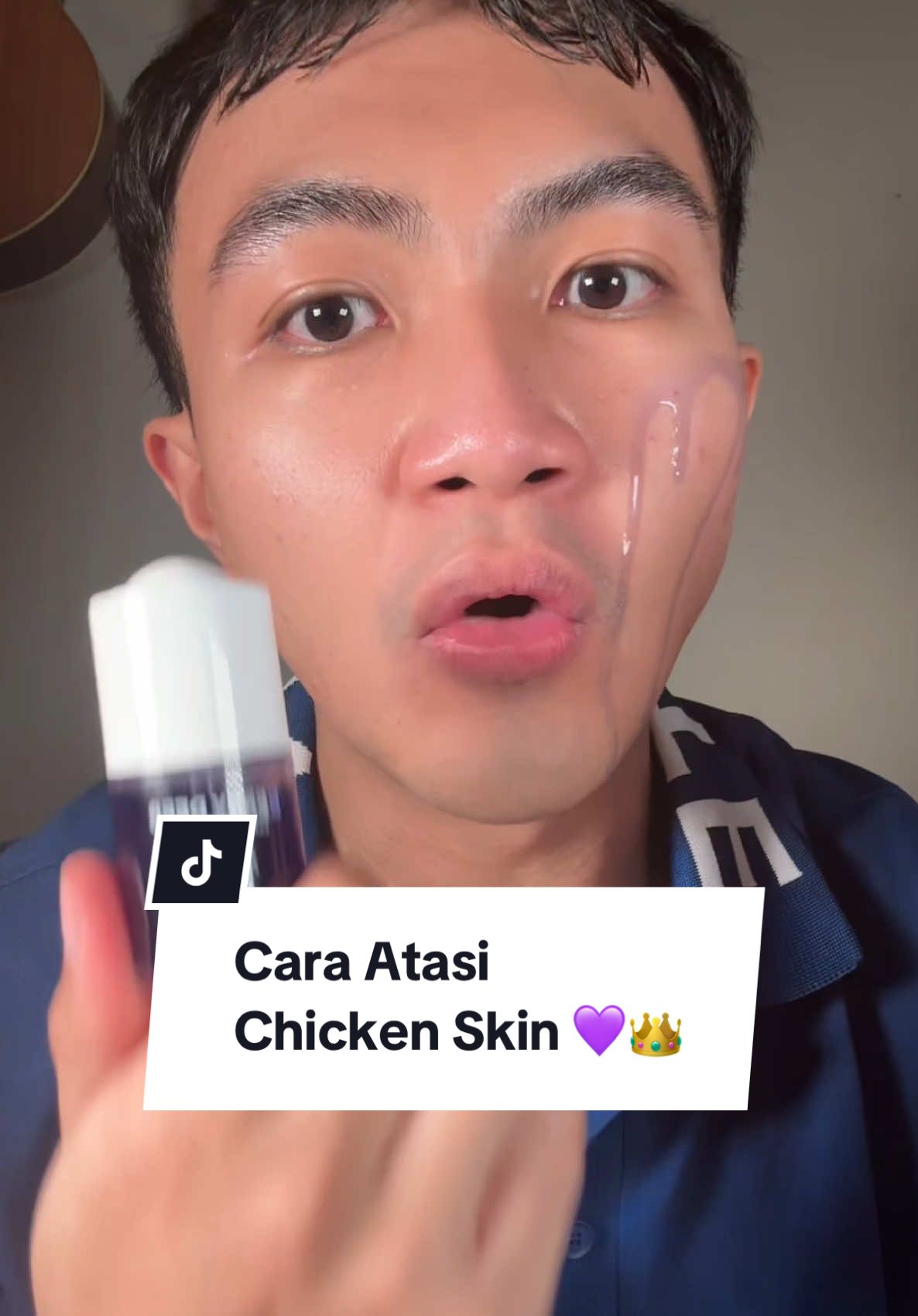 Cara atasin chicken skin dan tekstur kulit geradakan versi #kerajaanglowing ! 💜🥰👑✨ #promomakangajian #longervideos #belilokal #skincare #skincareviral #serum #serumviral #exfoliatingserum #peelingserum #FinallyFoundYou #FinallySimple 