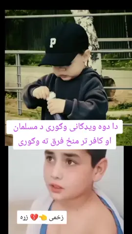 #زخمی👈💔زړه  #پشتون_تاجیک_هزاره_ازبک_زنده_باد🇦🇫  #ملګری_د_ژوندی_وی_🇦🇫💪🇦🇫❤  #جمهوریت_زندۀ_آباد🇦🇫🇦🇫🇦🇫🇦🇫 