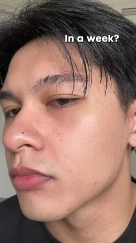 My confidence after 🙌 #fyp #poremizing #pinkampoule #pinkpamore #poreminimizer #poreskin #largepores #texturedskin #acneskin #oilyskin #pinkskincare #skin1004