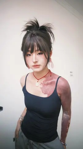 Coolness is a feeling#Birthmark #contrast 