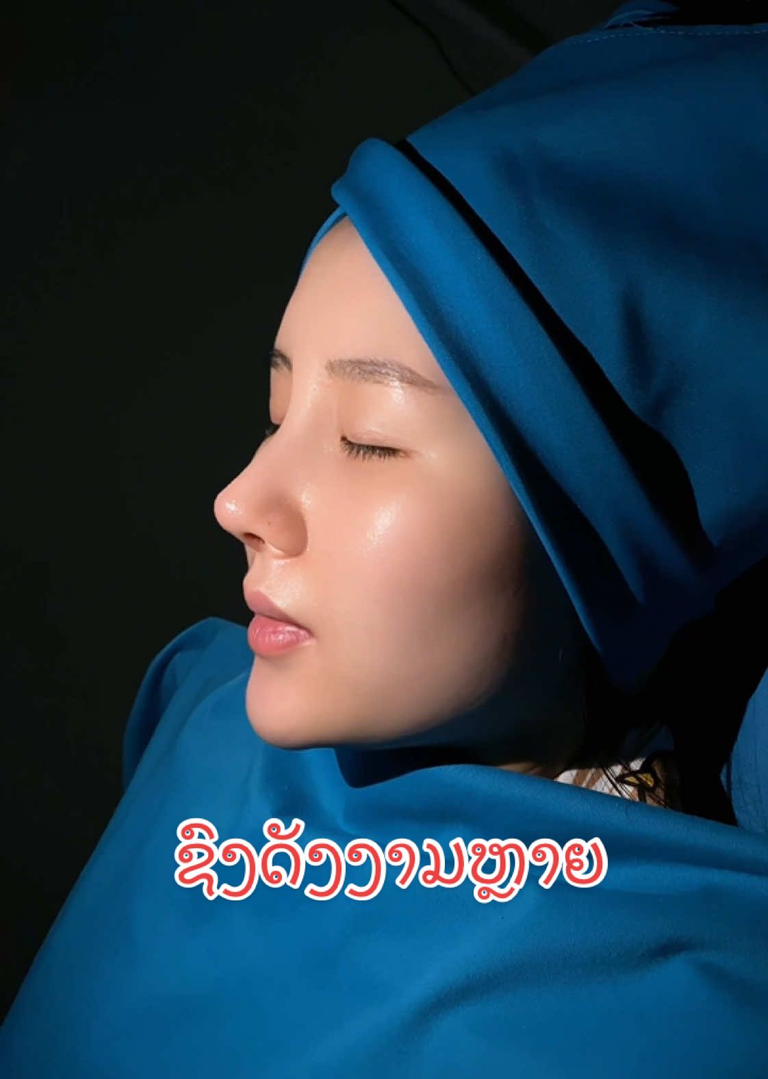ຊົງດັງທີ່ທຸກຄົນມັກທີ່ສຸດ #ເສີມດັງ #ເເກ້ດັງ #ລີວິວເສີມດັງ #ເສີມດັງປັບໂຄງສ້າງ #ດັງງາມ #ຄຣີນິກເສີມຄວາມງາມນະຄອຮຫຼວງວຽງຈັນ #ຄຣີນິກເສີມຄວາມງາມnewseoul #fyp