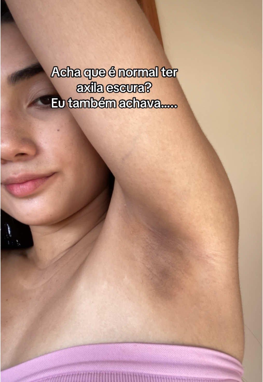 Não é normal, ou é falta de cuidado ou é resistência à insulina e a falta de cuidado é muito fácil de resolver com esse clareador 👌🏻 #dicasdebeleza #mulheres #fyp 