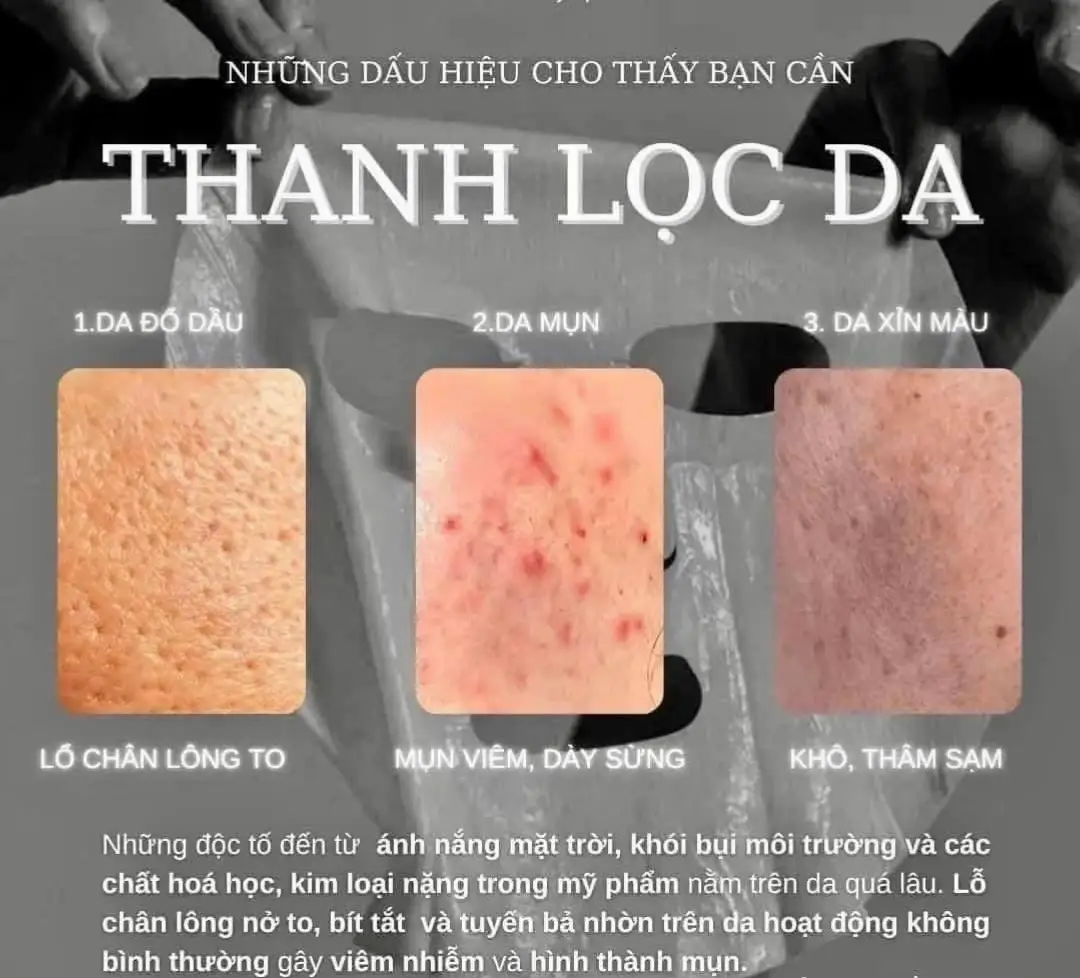 𝗧𝗛𝗔̉𝗜 Đ𝗢̣̂𝗖 𝗖𝗢𝟮 - 𝗧𝗛𝗔𝗡𝗛 𝗟𝗢̣𝗖 𝗗𝗔  Liệu pháp thải độc C02 Carboxy Therapy tại Spa là phương pháp đưa CO2 – 1 loại khí quen thuộc trong tự nhiên nhằm kích thích các mao mạch hoạt động hết công suất từ đó sinh ra Oxy tự nhiên cho da. Quá trình này nhằm đào thải độc tố, mụn và chất bẩn có trong da cũng như thanh lọc da sâu, đem lại làn da sáng, sạch mụn và săn chắc hơn. 🖇 Những ai cần thải độc CO2: ▪️ Da có mụn, da viêm nhiễm. ▪️ Da nhờn, lỗ chân lông to ▪️ Da sần, khô ráp, da có mụn (tất cả các loại mụn) ▪️ Da bị nhiễm độc Corticoid, chì và các kim loại nặng, nhiễm khuẩn ▪️ Thường xuyên sử dụng mỹ phẩm, make up Thường xuyên làm việc ngoài trời và trong môi trường bụi bẩn, có chứa chất độc hại ▪️ Muốn da sạch từ sâu bên trong và mong muốn hiệu quả dưỡng da nhanh hơn. ‼️ Hiệu quả mang lại: ✔️ Da khoẻ, sạch sâu ✔️ Da căng bóng, sáng mịn ✔️ Se khít lỗ chân lông, giảm mao mạch ✔️ Giảm dầu nhờn ✔️ Chống lão hoá ✔️ Giảm sưng mụn, nhanh phục hồi da👍 ✨HƯƠNG KEM SPA✨ 🏡 Ô M02 , đối diện quán nhậu Hoàng Minh, chợ đêm 1, cửa khẩu mộc bài, Bavet Tư vấn, book lịch  làm đẹp : @huongluly_1994 @huongkemspa68 -Mở cửa từ  11:00-2h  🏡 Chợ đêm 1 ,bavet mộc bài campodia ☎️071 827 5874