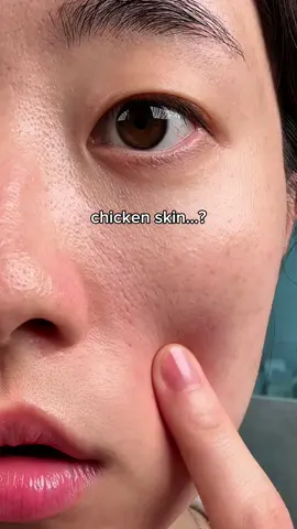 fixed my textured in ONE step☝🏻 #skincare #skincaretips #koreanskincare #texturedskin #chickenskin #essence #serum #viralskincare #pores #acneproneskin #haruharuwonder #fyp  @haruharu wonder 