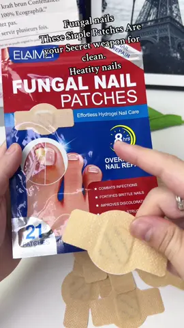 Fix uglynails while you sleep these, patches saved me #NailTok #FiYourNails #FungalNailSolutin #AmazonMustHaves #TikTokMadeMeBuyit #SkincareBÚtËorNäils #NailTransformation #beforeafter #SelfCareTools #HealthyNailsJourney. #OvernightFix #byeuglynails #useful #foryo 