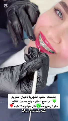 #تقويم_اسنان #تقويم_الاسنان🦷 #تقويم_شفاف #تقويم_معدني #مثبت_التقويم #مشاهير_تيك_توك_مشاهير_العرب #العراق🇮🇶 #مورفو🦋 #اطباء_العراق #تقويم_الاسنان🦷 #طبيبة_اسنان #اطباء_العراق 