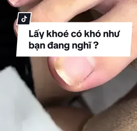 Trước khi biết lấy là phải hiểu #laykhoemongchan #alphanailhcm #lấykhoémóng #khoé #laykhoechan #laykhoe 