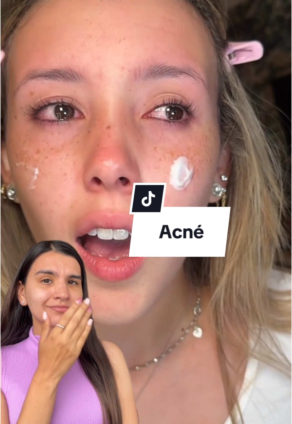 Ustedes lo usarian? 🫣 #skincare #acne #cuidadodepiel #vtcosmetics #skincarecoreano #cosméticacoreana #reedleshot #kbeauty #skinbooster #glassskin #microneedlin  @vtcosmetics_latam @VT Cosmetics US 