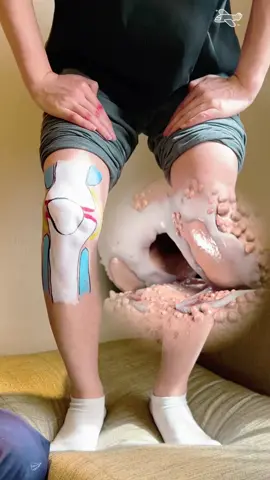 ¿Ruido de rodillas? ¿Dolor de rodilla? En realidad, la causa es bastante sencilla#painrelief #clearzal #clearzalgel #fyp 