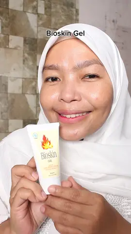 bisa meringankan luka bakar aku ud coba selalu sedia Bioskin Gel dirumah @Bioskin Gel Official  #BawaBioskinGelSebelumTerbakar #lessolesolesbeless 