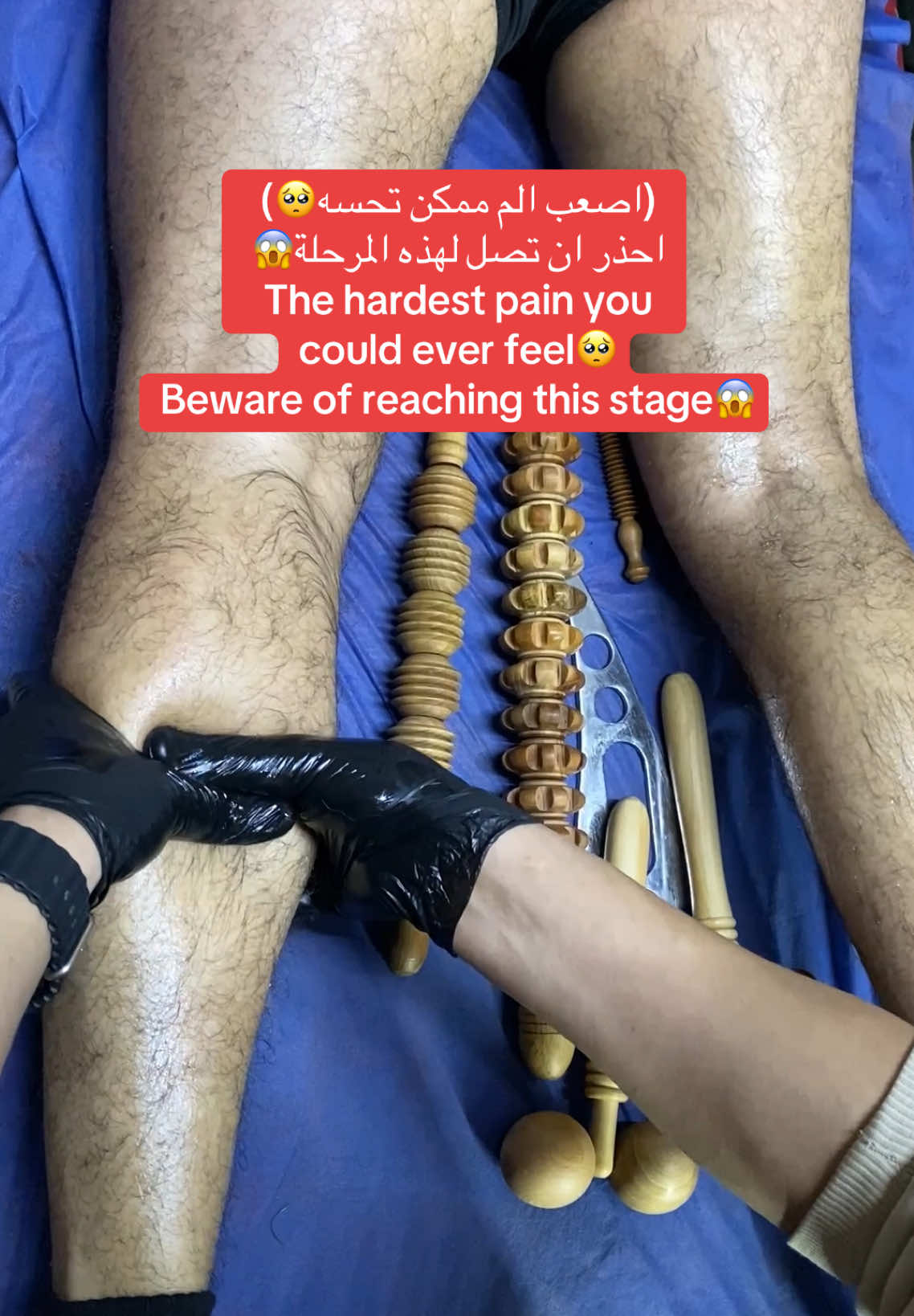 #حمض_اللاكتيك #العقد_العضلية #الم_العضلات #التعب_العضلي #دكتور_محمد_عبدالعزيز_تأهيل #dr_mohamed_abdelaziz 