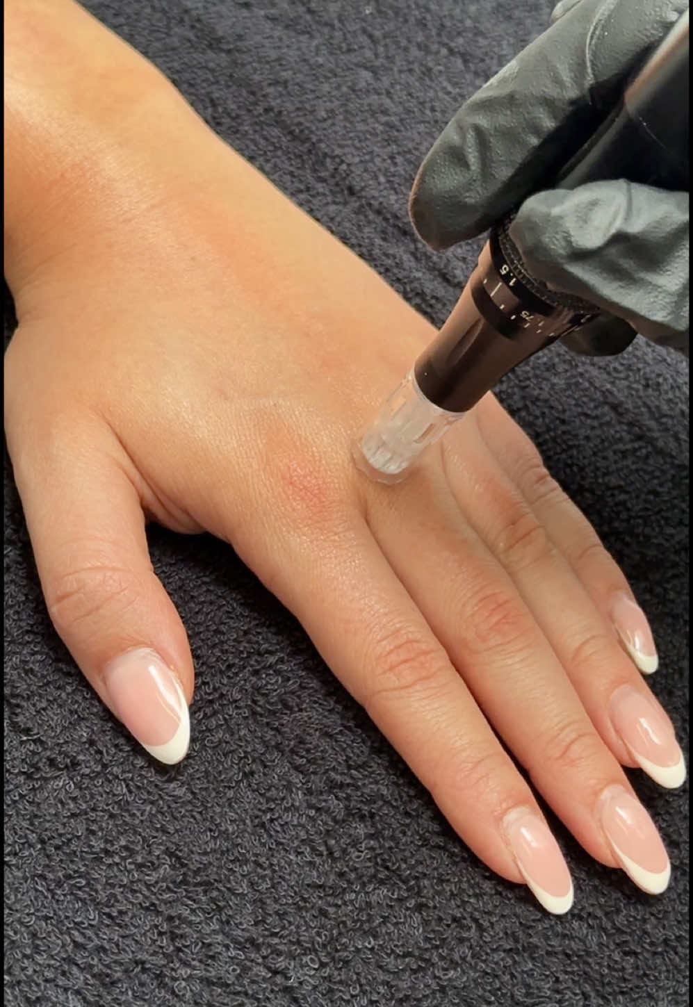 Microneedling your hands once a year has multiple benefits: - Increase collagen production - Reduce signs of ageing - Reduce pigmentation and age spots #microneedling #handmicroneedling #medimd #medicalgradeskincare #aesthetics #reverseageing 