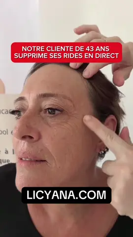 RESULTAT EN DIRECT #antiaging #antiwrinkle #tipsandtricks 