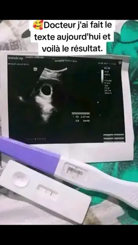 Tomber enceinte rapidement dans un mois  #fertilité #enceinte #fécondité #grossesse #malitiktok🇲🇱 #france #canada_life🇨🇦 #togo #cotedivoire🇨🇮225 #senegalaise_tik_tok #camerountiktok🇨🇲 #maroc #marocaine🇲🇦 #congo #bukinafaso🇧🇫🇧🇫 