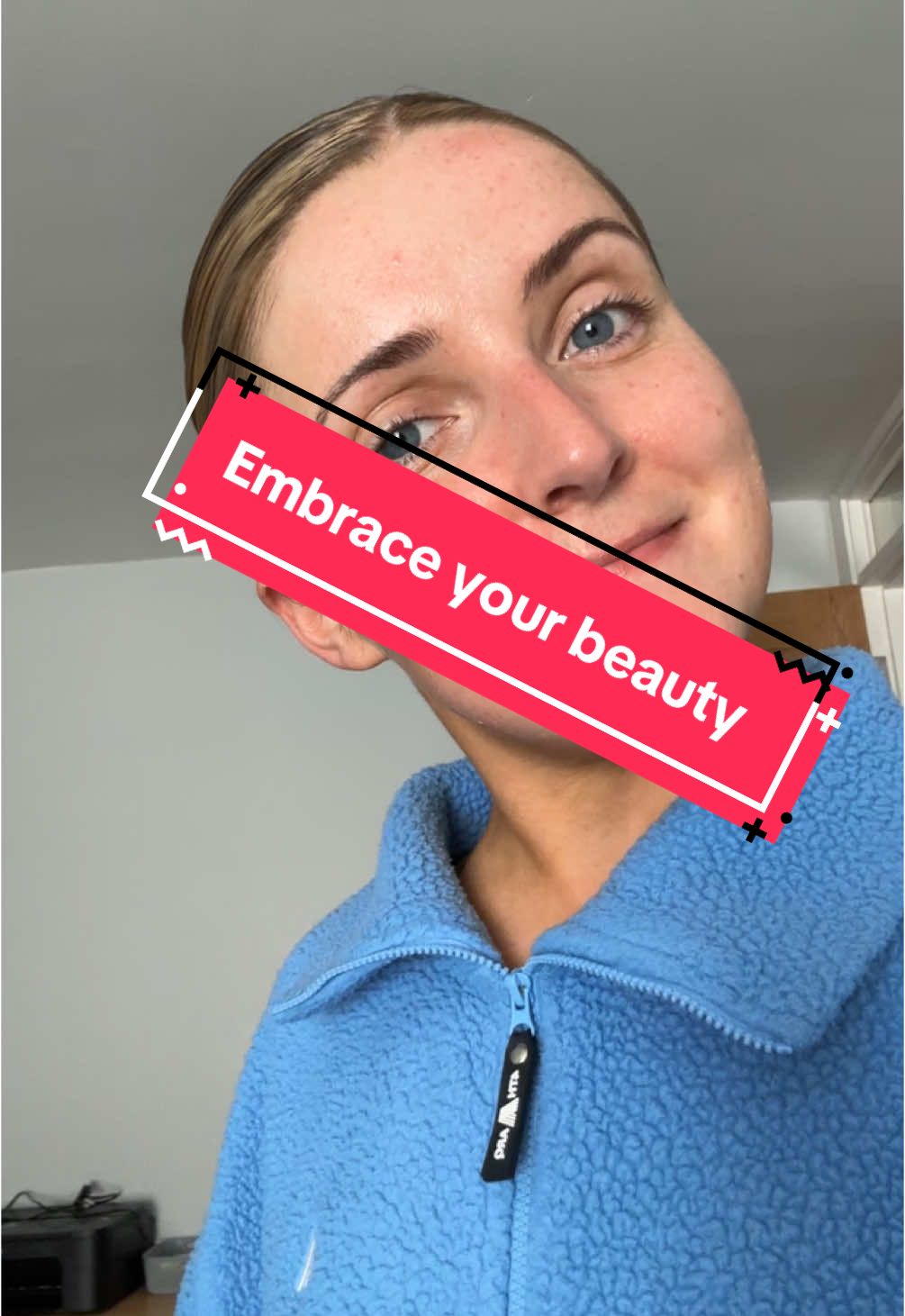 Embrace your imperfections. ❤️ #foryoupage #xybca #fyp 