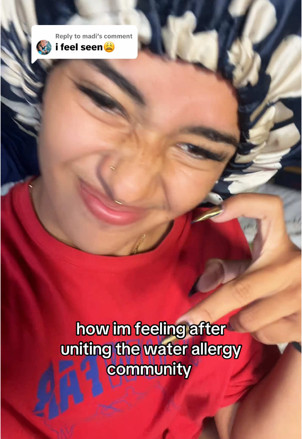 Replying to @madi but like a on a real note yall it makes my heart happy to see how many of yall have been struggling with this and are able to connect, shoutout yall #allergictowater #fyp #rareallergygang 