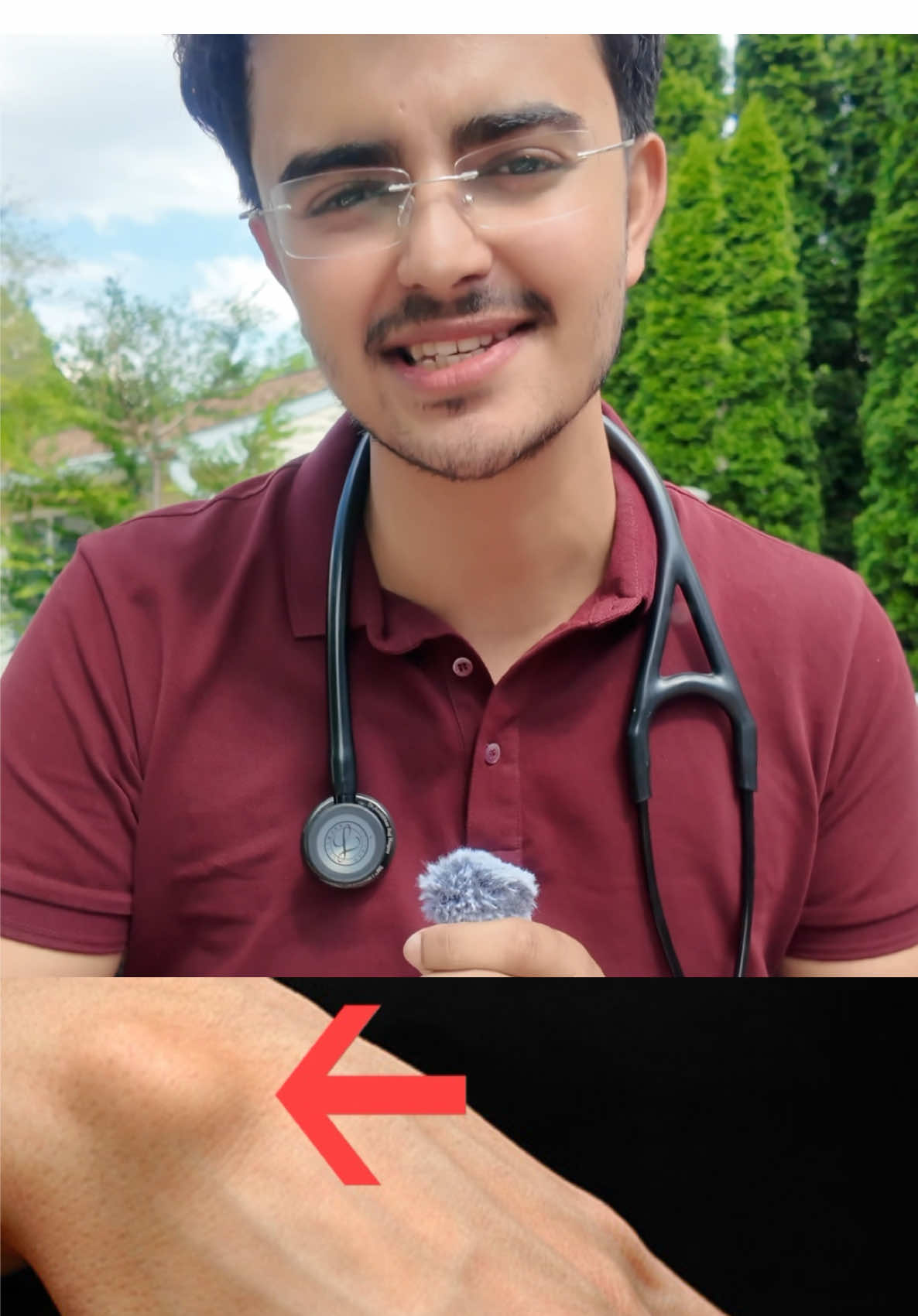 A ganglion cyst is a noncancerous, fluid-filled lump that commonly forms near joints or tendons, especially on the wrist or hand. It may vary in size, can feel firm or spongy, and is usually painless, though it can cause discomfort or limit movement if it presses on nearby nerves. The exact cause is unknown but may relate to joint or tendon irritation. Most ganglion cysts go away on their own, but treatment options include observation, aspiration (draining the fluid), or surgical removal if painful or persistent. #fyp #draavishkar #nepalidoctor #nepali #doctor #food #Vlog #travel 