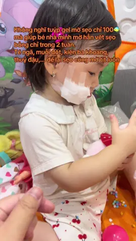 Nhà có con nhỏ không thể thiếu được tuýp gel này các mẹ ạ 😁 