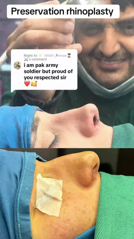 #foryou #dribrarent #dribrarrhinoplasty #rhinoplastyparachinar #nosejobparachinar #rhinoplastypakistan #rhinoplastyiran #rhinoplastyturkey 
