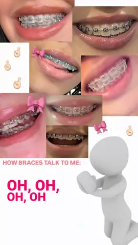 HOW BRACES TALK TO ME: • • • • • • • • • #bemybaby #braces #pinkbraces #aesthetic #aestheticbraces #everyone #foryourpage #fyp #fyppppppppppppppppppppppp #trend #illmakeyouhappy #manifesting #bracescolors 