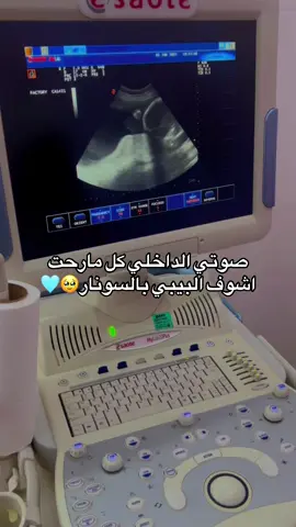 🥹🩵.#الشعب_الصيني_ماله_حل😂😂 #بيبي #explore #fypシ #🤍 #نور 