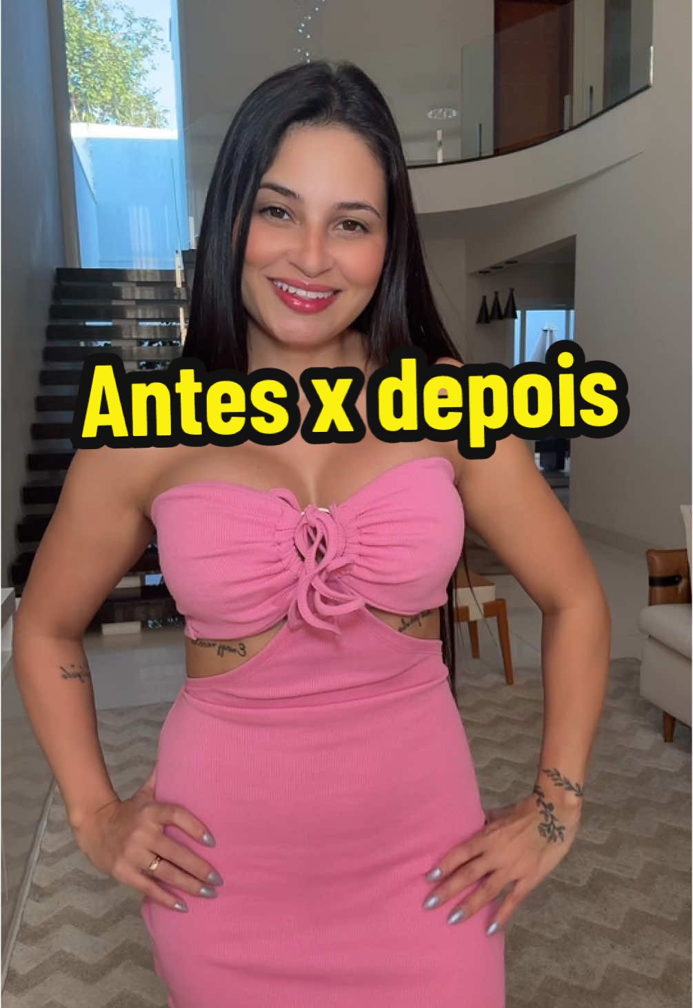 Mais um antes e depois do meu sonho realizado 🥹 #silicone #mastocomprotese #cirurgiaplastica 