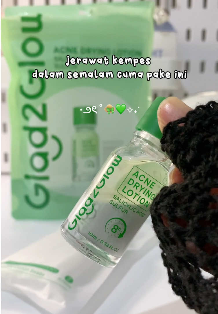 Jerawat kempes dalam semalam #glad2glow #newlaunch #acnedryinglotion #g2g #jerawatkempes #fyp 