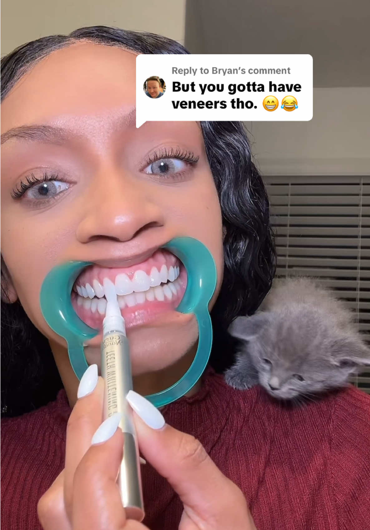 Replying to @Bryan  The new Gurunanda whitening wireless kit is the GOAT! You can see whiter teeth after just one use. It comes with hydrogen peroxide gel and a blue led light to activate and enhance the gels effectiveness. It also comes with whitening strips, a mouth retractor, a tongue scraper and oil pulling rinse to keep your teeth white. Love it! 💕 #gurunanda #teethwhitening #gurunandawirelesswhiteningnewarrival #gurunandasuperbrandday #whiteteeth #whiteningstrips @GuruNanda LLC @Puneet Nanda bridge the gap 