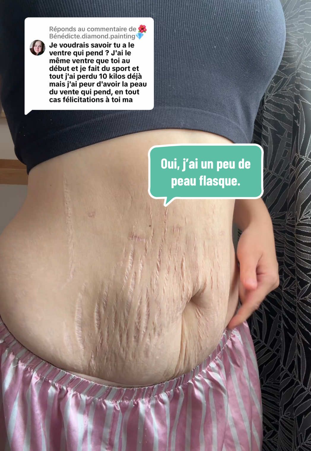 Réponse à @🌺Bénédicte.diamond.painting💎 #sleevejourney #pertepoids #peauflasque #vraiemaman #sleeveavantapres #realité #transformationcorporelle #postop #reconstruction #corpsenreconstruction #slay #mamansolo #sororité 