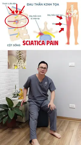 Bai tập thần kinh tọa #drtronghung #vatlytrilieu #coxuongkhop #yhoccotruyen #tip 