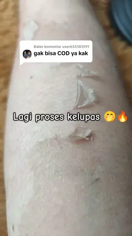 Membalas @user655181591  #hbkelupas  #hbdosting  #hbwhitening  #pemutihbadan 