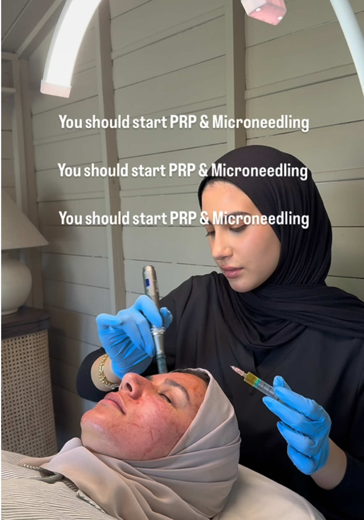 Your sign to book in that Microneedling session💉🤍✨ For bookings contact +44 7342 836896 #microneedling #plasma #prp #vampirefacial #skinbooster #acnescarring #hyperpigmentation #pores 