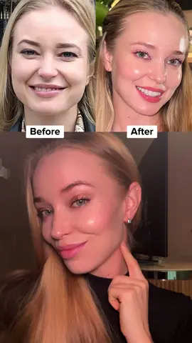Try this self osteopathy technique for your undereyes #SelfCare#facemassage 