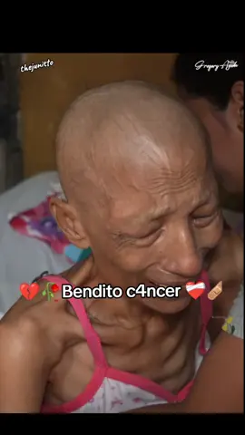 El C4NCER la dejó así, se le notan sus hu3sito$😔💔#triste #cancer #ayuda #mujeres #tristeza #dolor #enfermedad #noticias #fyp 