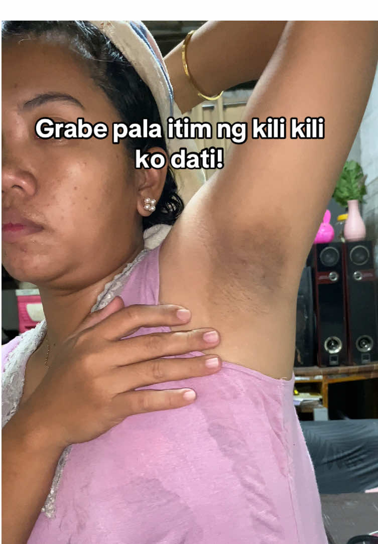 Grabe diko inexpect na ngayon ganto na kilikili ko huhu.kala ko wala ng pagasa #serum #dermorepubliqserum #glycolicacid 