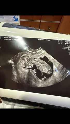 We are truly blessed  🙏🏾🙏🏾 giving all glory to God for our baby  can’t wait to finally meet you on December 23. God is truly an awesome God he does miracles and blessings  all glory goes to God thank you Jesus for everything you’ve done for us guide us and protect us. Give us strength to be the parents that you want us to be ##Baby##GodDoesMiracles##Blessed
