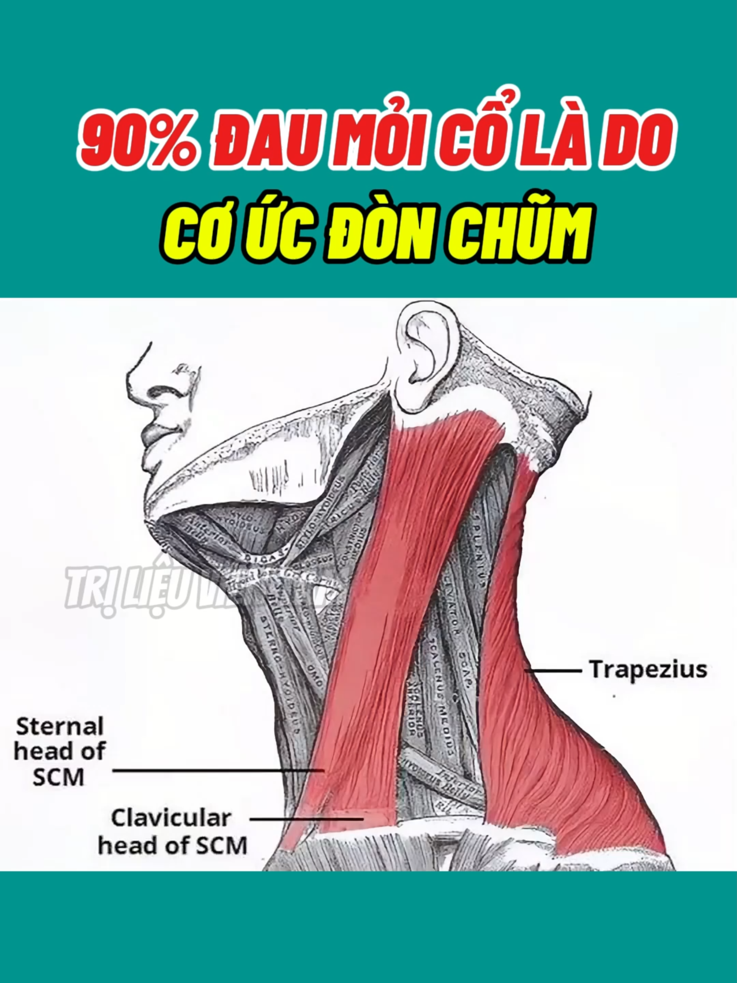 Đau mỏi cổ, đau lan ra sau đầu hoặc giật lên hốc mắt có thể là do cơ ức đòn chũm gây ra #daumoico #daudau #coucdonchum #viral #LearnOnTikTok #xhuongtiktok #hanoi #songkhoe