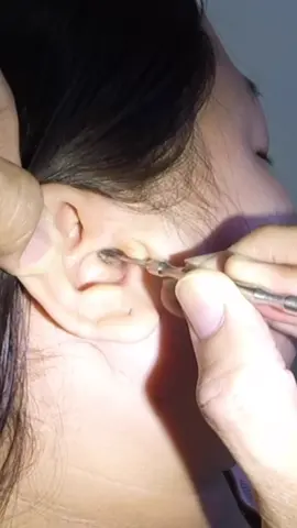 So HUGE #earwaxremoval #earcleaning #fyp #earwaxspecialist #earcare #cerumen