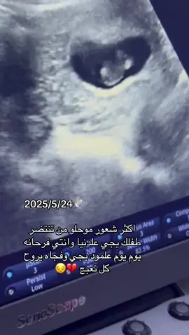 #عوضني_يارب_خيراً_عن_كل_شي #ارزق_كل_محروم_الذريه_الصالحه💖 #اجهاضات_متكررة #لاتذرني_فردا_وأنته_خير_الوارثين #5 #جنين 