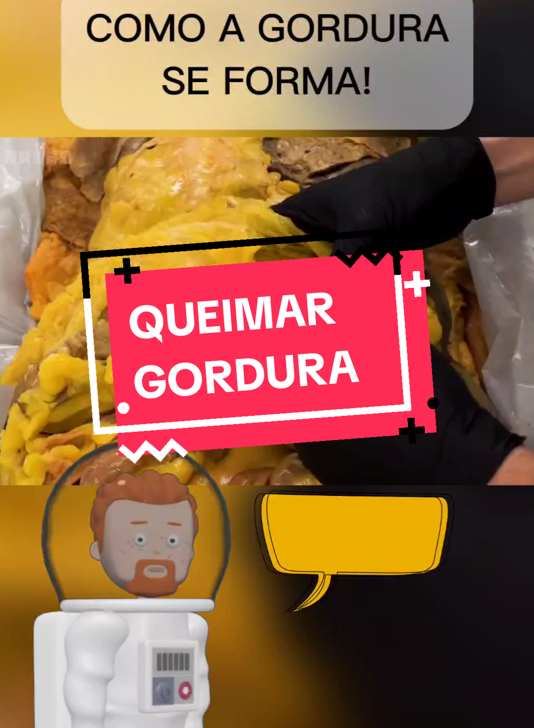 Como queimar gordura 🧠. #gordura #curiosidades #exercícios #saúde 