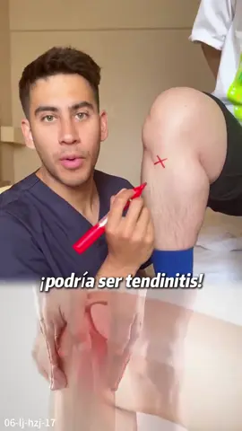Si tienes mucho dolor aquí, ¡podría ser tendinitis!#painrelief #clearzal #clearzalgel #fyp 