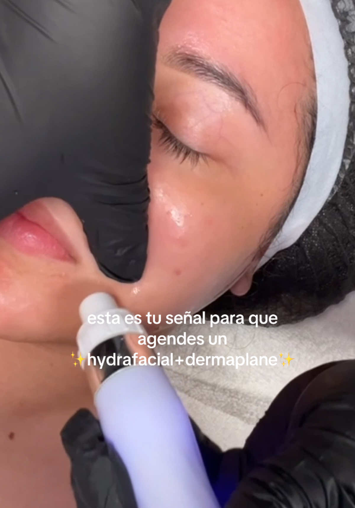 Heavennn feels like thisss✨ #fyp #skincare #hydrafacial #dermaplane #facial #cuidadodelapiel #oilyskin #fyppppppppppppppppppppppppppppppppppp  #parati #foryoupage #CapCut 