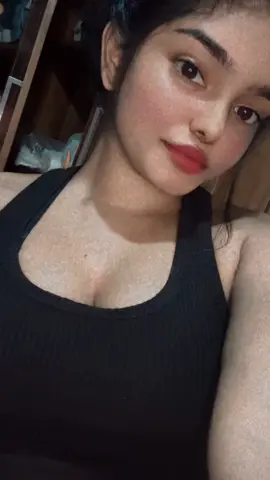 බර්ත් මාක් එක නිසා ඔය උඩු තොලේ!!😮‍💨🌚❤️‍🔥#cremsyyy #CapCut #viraltiktokvideos #goviral #1millionaudition #viraltiktok 