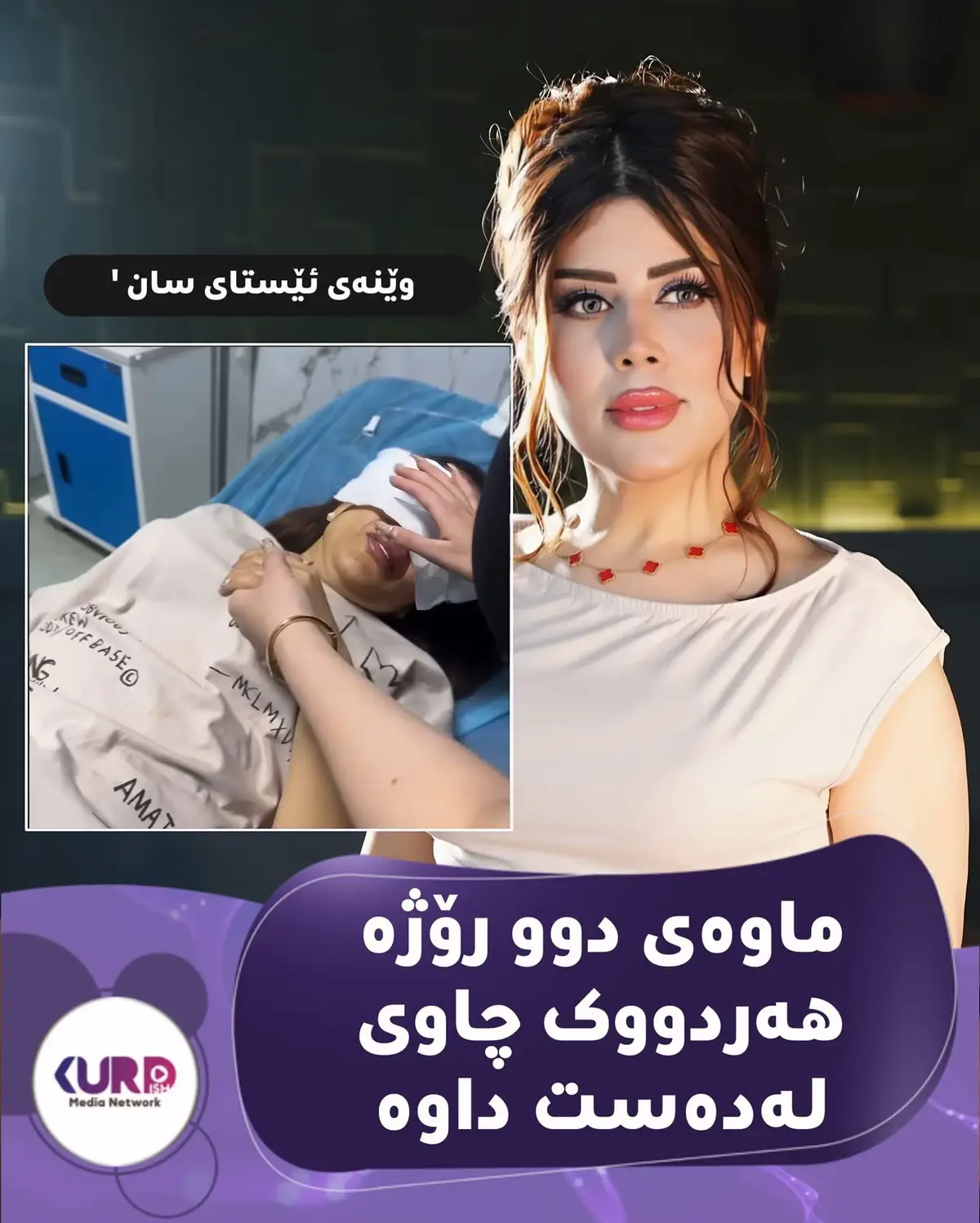 خانمە گۆرانیبێژ، سان  محەمەد  بۆ ماوەی دو رۆژە بینایی چاوەکانی   لەدەستداوە، داوای نزای چاکبونەوە لە هەوادارەکانی دەکات سان خانمێکی گۆرانیبێژە و ماوەی دوو رۆژە بەهۆی دانانی عەدەسەوە رۆشنای و بینینی چاوەکانی لەدەست دەدات داوا لە هاورێ و هەوادارەکانی دەکات لەم رۆژە پیرۆزە لە دوعاکانیان بێ بەشی نەکەن و نزای چاک بوونەوەی بۆ بکەن @san.mohammeed